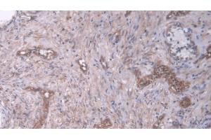 Detection of DUSP6 in Human Prostate Tissue using Polyclonal Antibody to Dual Specificity Phosphatase 6 (DUSP6)