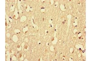 Immunohistochemistry of paraffin-embedded human brain tissue using ABIN7160576 at dilution of 1:100