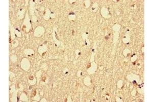 Immunohistochemistry of paraffin-embedded human brain tissue using ABIN7160576 at dilution of 1:100 (MYH3 anticorps  (AA 1-217))
