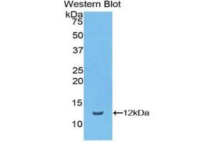 Western blot analysis of the recombinant protein. (Vitronectin anticorps  (AA 19-111))
