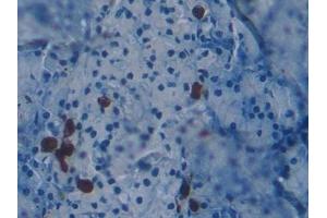 Detection of KHDRBS1 in Mouse Pancreas Tissue using Polyclonal Antibody to KH Domain Containing, RNA Binding, Signal Transduction Associated Protein 1 (KHDRBS1)