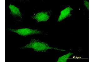Immunofluorescence of monoclonal antibody to CAMK1D on HeLa cell. (CAMK1D anticorps  (AA 1-95))