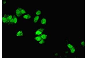 Immunofluorescent analysis of MCF-7 cells using ABIN7150882 at dilution of 1:100 and Alexa Fluor 488-congugated AffiniPure Goat Anti-Rabbit IgG(H+L)