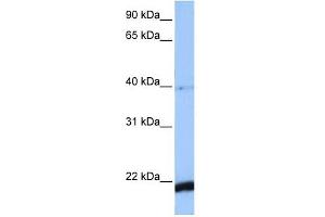 HBS1L antibody used at 1 ug/ml to detect target protein. (HBS1L anticorps)