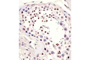 Antibody staining LIN28B in human testis tissue sections by Immunohistochemistry (IHC-P - paraformaldehyde-fixed, paraffin-embedded sections).