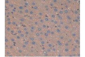 IHC-P analysis of Rat Liver Tissue, with DAB staining. (Haptoglobin anticorps  (AA 70-332))
