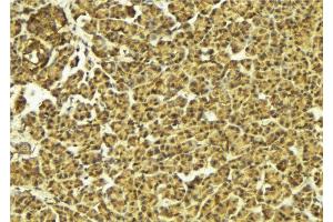 ABIN6274587 at 1/100 staining Mouse pancreas tissue by IHC-P.