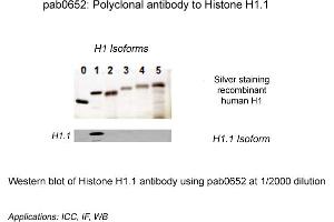 Image no. 1 for anti-Histone H1.1 (HIST1H1A) (N-Term) antibody (ABIN410162) (Histone H1.1 anticorps  (N-Term))