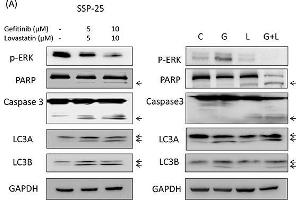 Combined treatment of gefitinib and lovastatin induced apoptosis and autophagy in SSP-25 cellsThe cells (1 x 106/well) were seeded in a six-well tray and treated with a combination of gefitinib and lovastatin for 24 hours.