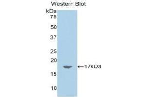 Detection of Recombinant CHEM, Rat using Polyclonal Antibody to Chemerin (CHEM) (CHEM (AA 25-152) anticorps)