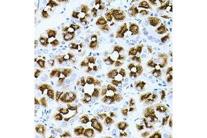 Immunohistochemistry of paraffin-embedded human stomach using DLK1 antibody.