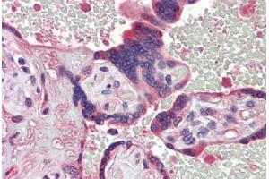 Human Placenta (formalin-fixed, paraffin-embedded) stained with  antibody ABIN462272 followed by biotinylated secondary antibody, alkaline phosphatase-streptavidin and chromogen. (TDP1 anticorps  (AA 1-298))