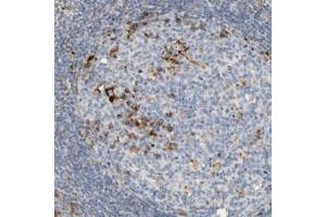 Immunohistochemical staining (Formalin-fixed paraffin-embedded sections) of human tonsil with CECR1 polyclonal antibody  shows strong cytoplasmic positivity in germinal center cells. (CECR1 anticorps)