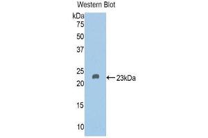 Western Blotting (WB) image for anti-Vitamin D-Binding Protein (GC) (AA 209-394) antibody (ABIN1858610) (Vitamin D-Binding Protein anticorps  (AA 209-394))