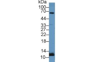 Detection of UCN2 in Rat Adrenal gland lysate using Polyclonal Antibody to Urocortin 2 (UCN2) (Urocortin 2 anticorps  (AA 20-112))