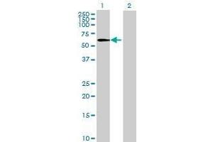 Lane 1: C14orf21 transfected lysate ( 58.