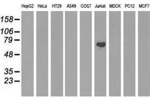 Western blot analysis of extracts (35 µg) from 9 different cell lines by using anti-ARHGAP25 monoclonal antibody. (ARHGAP25 anticorps)