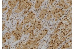 ABIN6276963 at 1/100 staining Human kidney tissue by IHC-P. (GLO1 anticorps  (Internal Region))