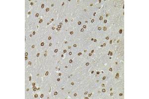 Immunohistochemistry of paraffin-embedded rat brain using CDX2 antibody (ABIN5970799) at dilution of 1/100 (40x lens). (CDX2 anticorps)