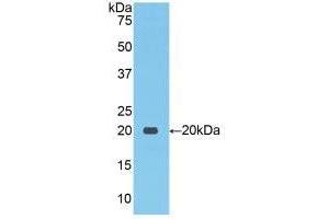 Western blot analysis of recombinant Human NCCT. (SLC12A3 anticorps  (AA 867-1024))