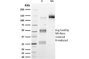 SDS-PAGE Analysis Purified Emerin Mouse Monoclonal Antibody (EMD/2167). (Emerin anticorps  (AA 56-167))