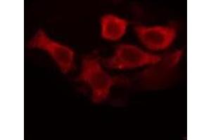 ABIN6276904 staining COLO205 cells by IF/ICC.