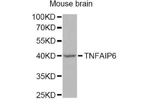 Western blot analysis of extracts of mouse brain, using TNFAIP6 Antibody (ABIN2560467) at 1:1000 dilution.