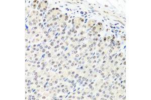 Immunohistochemistry of paraffin-embedded mouse stomach using CNOT8 antibody at dilution of 1:100 (x40 lens). (CNOT8 anticorps)