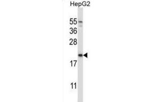 Western Blotting (WB) image for anti-NADH Dehydrogenase (Ubiquinone) 1 alpha Subcomplex, Assembly Factor 2 (NDUFAF2) antibody (ABIN2997290) (NDUFAF2 anticorps)