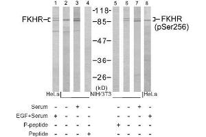 Image no. 1 for anti-Forkhead Box O1 (FOXO1) (pSer256) antibody (ABIN196813) (FOXO1 anticorps  (pSer256))