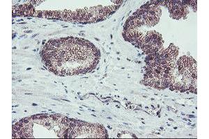 Image no. 5 for anti-Fragile X Mental Retardation 1 (FMR1) (AA 26-279) antibody (ABIN1491292)