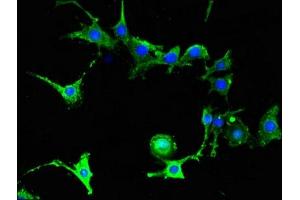 Immunofluorescent analysis of MCF-7 cells using ABIN7152652 at dilution of 1:100 and Alexa Fluor 488-congugated AffiniPure Goat Anti-Rabbit IgG(H+L)