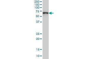 CTNNBL1 monoclonal antibody (M01), clone 5F1 Western Blot analysis of CTNNBL1 expression in Hela S3 NE .