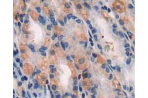 IHC-P analysis of stomach tissue, with DAB staining. (TUBB1 anticorps  (AA 166-451))