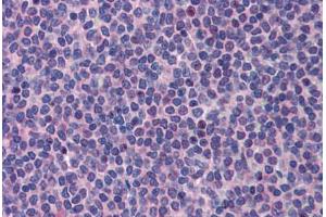 anti-Promyelocytic Leukemia (PML) (AA 588-637) antibody