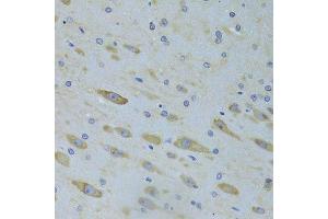 Immunohistochemistry of paraffin-embedded rat brain using SARS Antibody.