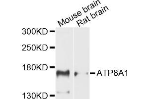 Western blot analysis of extracts of various cell lines, using ATP8A1 antibody (ABIN5971746) at 1/1000 dilution. (ATP8A1 anticorps)