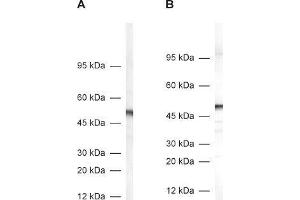 dilution: 1 : 1000, A: rat adrenal gland homogenate, B: mouse brain homogenate