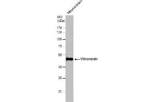 WB Image Vitronectin antibody detects Vitronectin protein by western blot analysis. (Vitronectin anticorps)