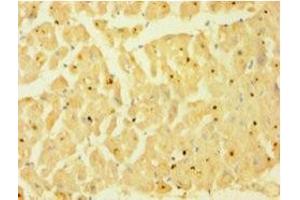 Immunohistochemistry of paraffin-embedded human heart tissue using ABIN7146925 at dilution of 1:100 (Caspase 1 anticorps  (AA 120-269))