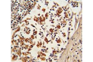 IHC analysis of FFPE human lymph tissue with BCL6 antibody
