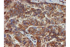 Image no. 9 for anti-Sec1 Family Domain Containing 1 (SCFD1) antibody (ABIN1500819)