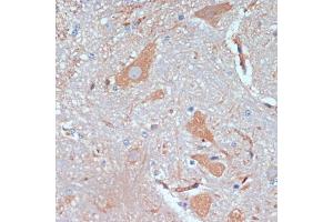 Immunohistochemistry of paraffin-embedded mouse spinal cord using KIF5B antibody (ABIN7268136) at dilution of 1:200 (40x lens).