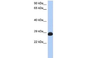WB Suggested Anti-RAB39B Antibody Titration: 0.