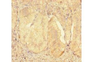 Immunohistochemistry of paraffin-embedded human adrenal gland tissue using ABIN7176128 at dilution of 1:100 (ZNF175 anticorps  (AA 1-711))