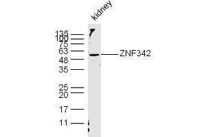 Mouse kidney lysates probed with ZNF342/ZNF296 Polyclonal Antibody, unconjugated  at 1:300 overnight at 4°C followed by a conjugated secondary antibody at 1:10000 for 60 minutes at 37°C. (Zinc Finger Protein 296 (ZNF296) (AA 231-350) anticorps)