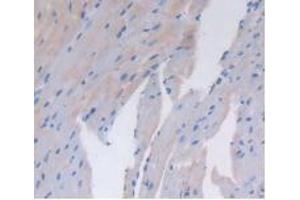 Detection of CD26 in Mouse Heart Tissue using Polyclonal Antibody to Cluster Of Differentiation 26 (CD26) (DPP4 anticorps  (AA 29-178))