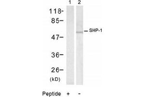 Image no. 2 for anti-Protein-tyrosine Phosphatase 1C (PTPN6) (Tyr536) antibody (ABIN197592) (SHP1 anticorps  (Tyr536))