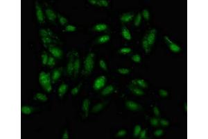 Immunofluorescence staining of Hela cells with ABIN7156618 at 1:100, counter-stained with DAPI.
