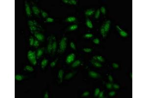 Immunofluorescence staining of Hela cells with ABIN7156618 at 1:100, counter-stained with DAPI. (IRF2BP1 anticorps  (AA 340-499))
